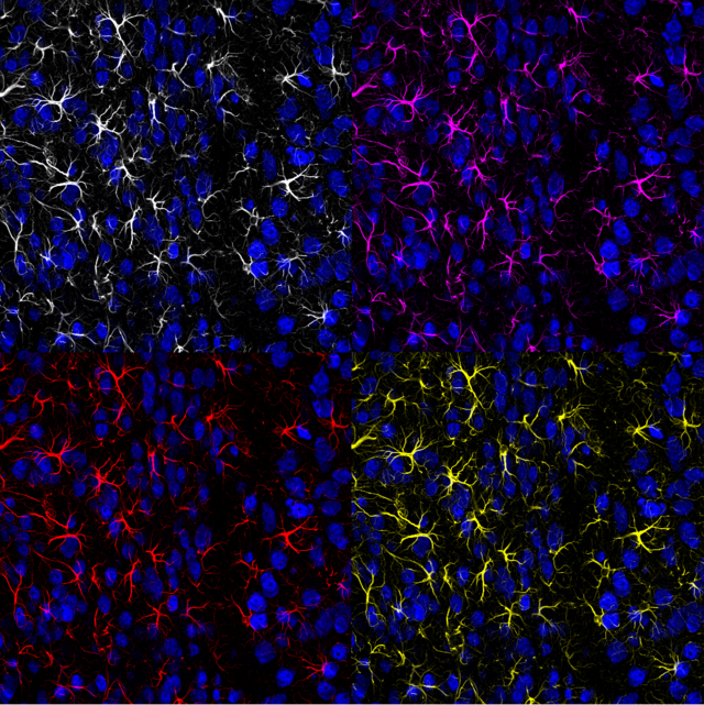 Astrocytes (yellow, white, purple and red) and neurons (blue) from a mouse brain.